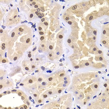 PRDM14 Antibody
