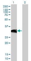 IHC-plus™ Monoclonal Mouse anti-Human BCL11A Antibody (clone 3D9, IHC, WB)