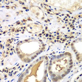 PSME2 Antibody