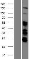 ARID5B Protein (Over-Expression Lysate Myc-DDK (Flag))