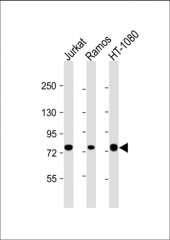 Monoclonal Mouse anti-Human GARS / Glycyl tRNA Synthetase Antibody (clone 1641CT837.23.96, aa15-305, WB)