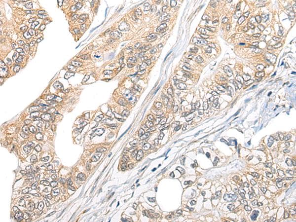 Polyclonal Rabbit anti-Human TBCB / CKAP1 Antibody (IHC, WB)