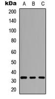 CD274 / B7-H1 / PD-L1 Antibody (Internal)