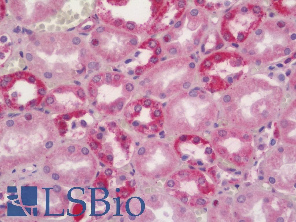 IHC-plus™ NIP3 / BNIP3 Antibody (aa47-96)