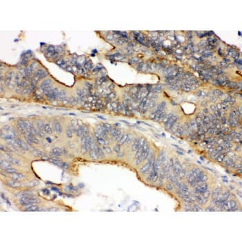 OSM / Oncostatin M Antibody (aa26-220)