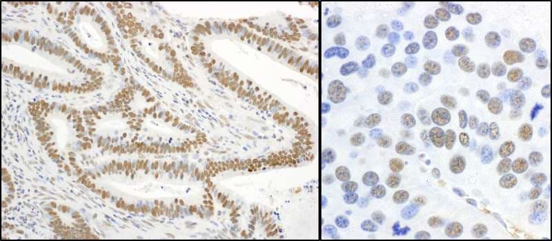Polyclonal Rabbit anti-Human XRCC1 Antibody (phospho-Ser485 / phospho-Thr488, IHC, WB)