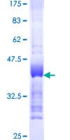 Human ERIC-1 / TACC3 Protein (Recombinant GST, N-terminus)