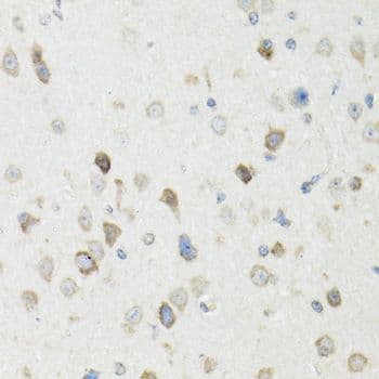 Polyclonal Rabbit anti-Human Vasohibin 1 / VASH1 Antibody (IHC, WB)