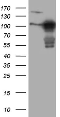 MLPH / Melanophilin Antibody (aa295-600, clone OTI6E3)