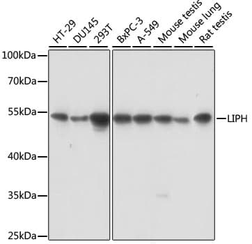 Polyclonal Rabbit anti-Human LIPH / Lipase Member H Antibody (WB)