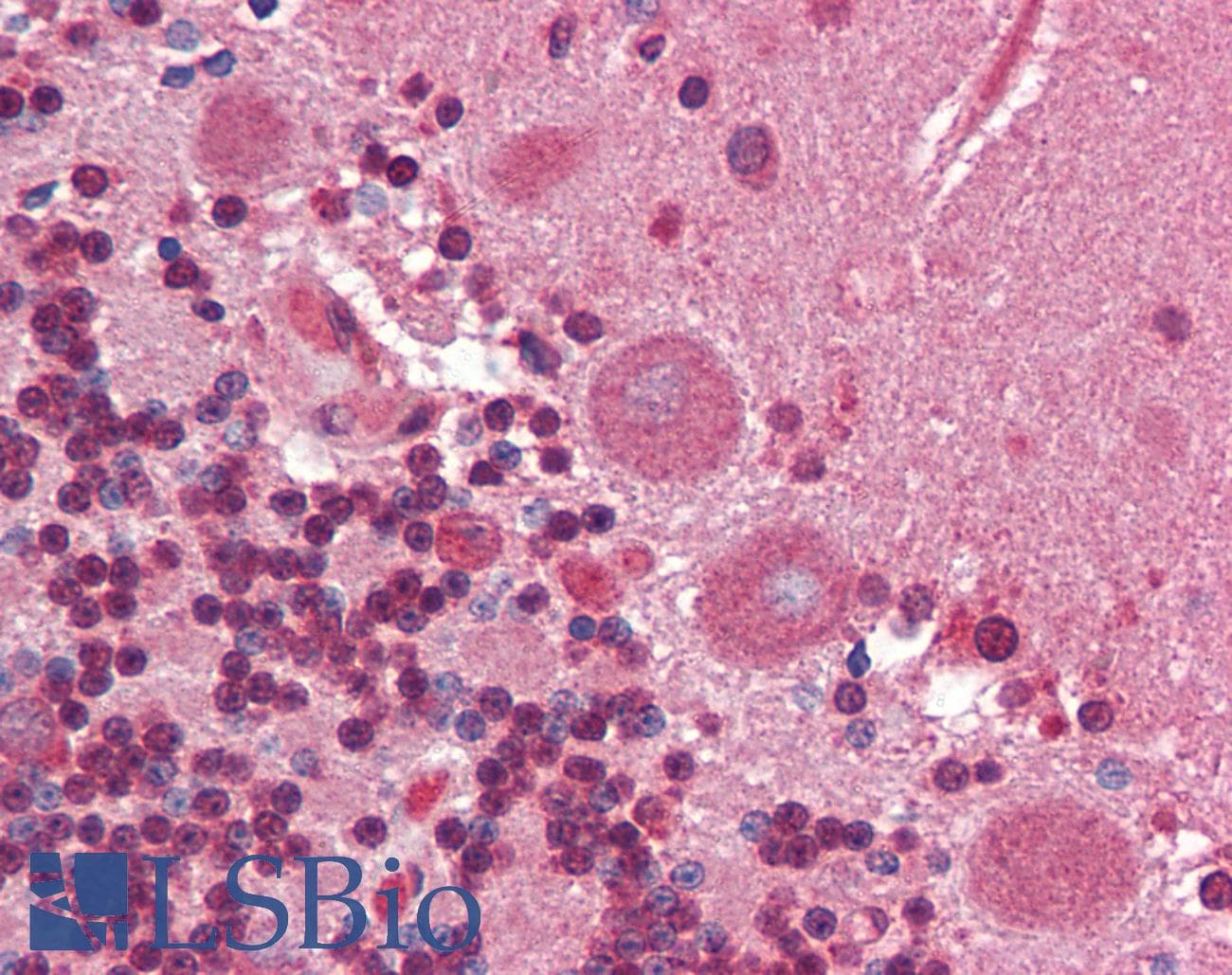 IHC-plus™ Collagen I Antibody