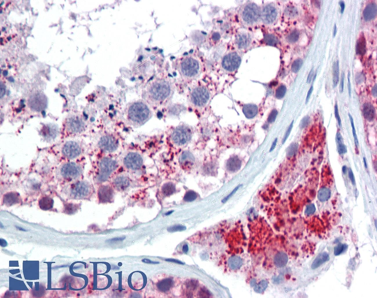 IHC-plus™ Polyclonal Rabbit anti-Human CDH1 / E Cadherin Antibody (aa1-50, IHC, IF, WB)