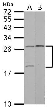 Polyclonal Rabbit anti-Human YAF2 Antibody (IF, WB)