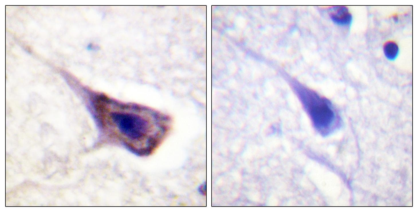 BAD Antibody (phospho-Ser134)