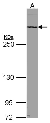 ATRX Antibody (aa2161-2443)