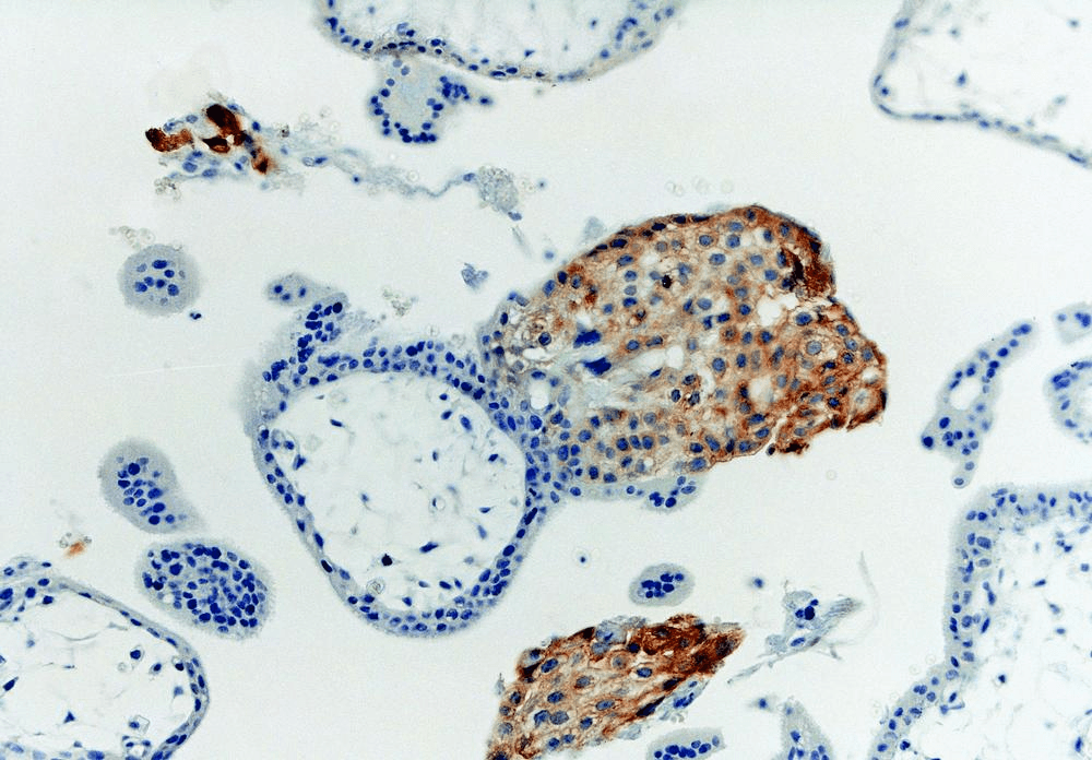 Monoclonal Mouse anti-Human HLA-G Antibody (clone MEM-G/1, IHC, WB)