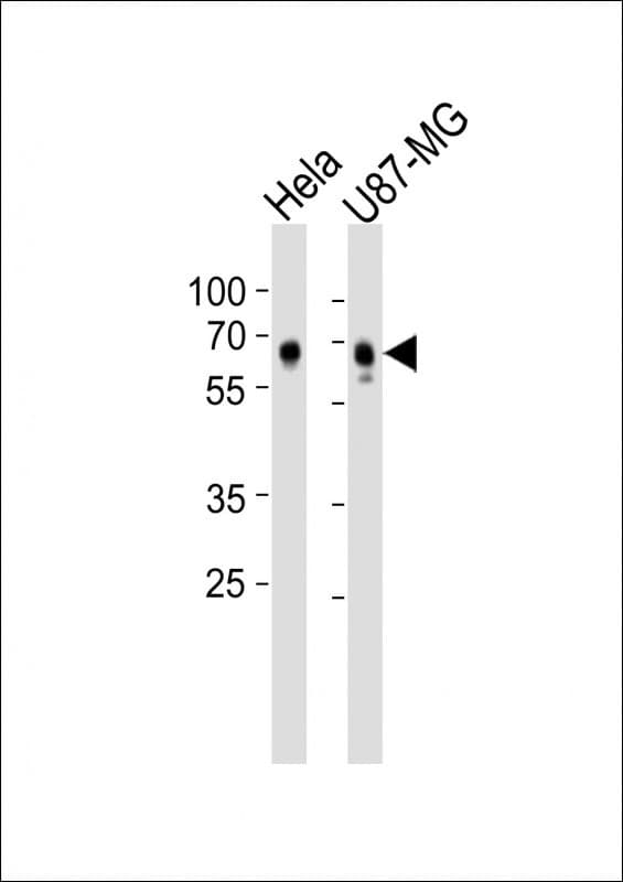 ADGRG1 / GPR56 Antibody (clone 1443CT377.65.29)