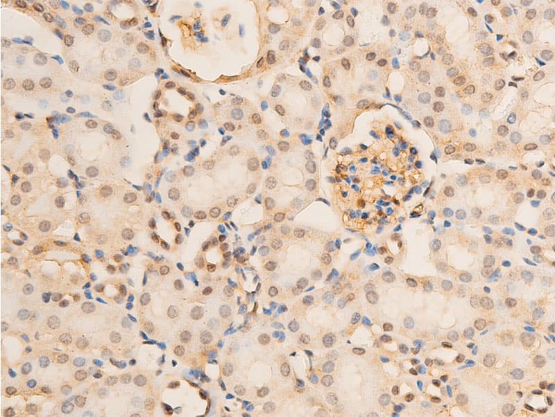 RELA / NFKB p65 Antibody (phospho-Ser536)