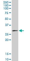 Monoclonal Mouse anti-Human FAM3B Antibody (clone 1E7, IHC, WB)