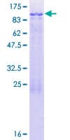 Human CCDC40 Protein (Recombinant GST)