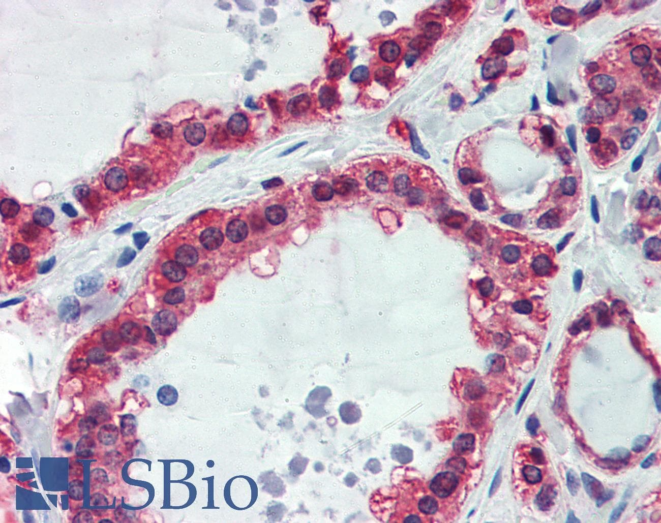 IHC-plus™ GAPDH Antibody