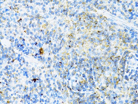 Polyclonal Rabbit anti-Human CD8A / CD8 Alpha Antibody (IHC, WB)