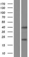 LGALS9B Protein (Over-Expression Lysate Myc-DDK (Flag))