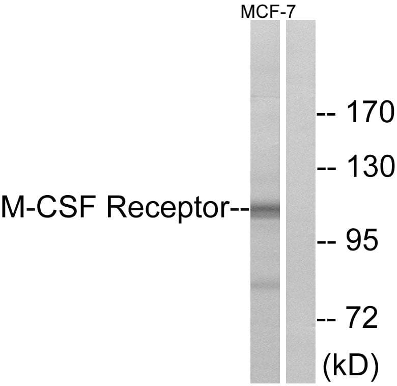 CSF1R / CD115 / FMS Antibody (p723)