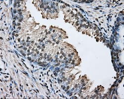 ARNT / HIF-1-Beta Antibody (clone OTI1D10)