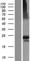 CFAP20 / GTL3 Protein (Over-Expression Lysate Myc-DDK (Flag))