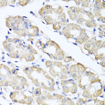 SPICE1 / CCDC52 Antibody