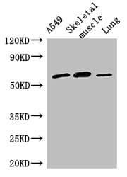 Polyclonal Rabbit anti-Human AOAH / Acyloxyacyl Hydrolase Antibody (IHC, WB)