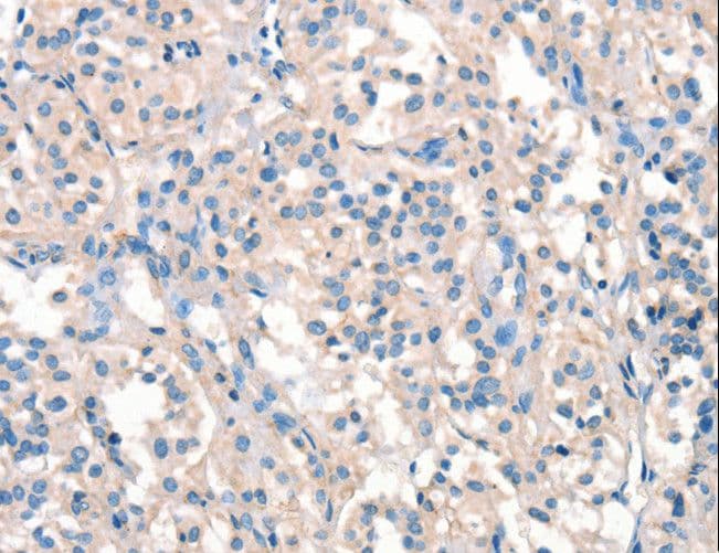 ARHGEF11 Antibody