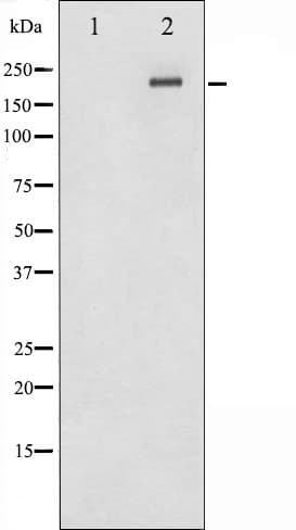 Polyclonal Rabbit anti-Human MTOR Antibody (phospho-Thr2446, WB)