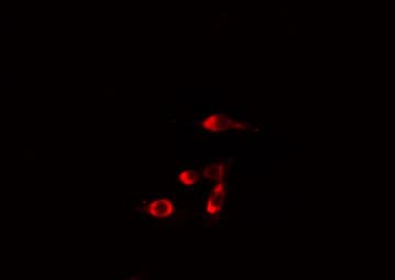 RAD51C Antibody