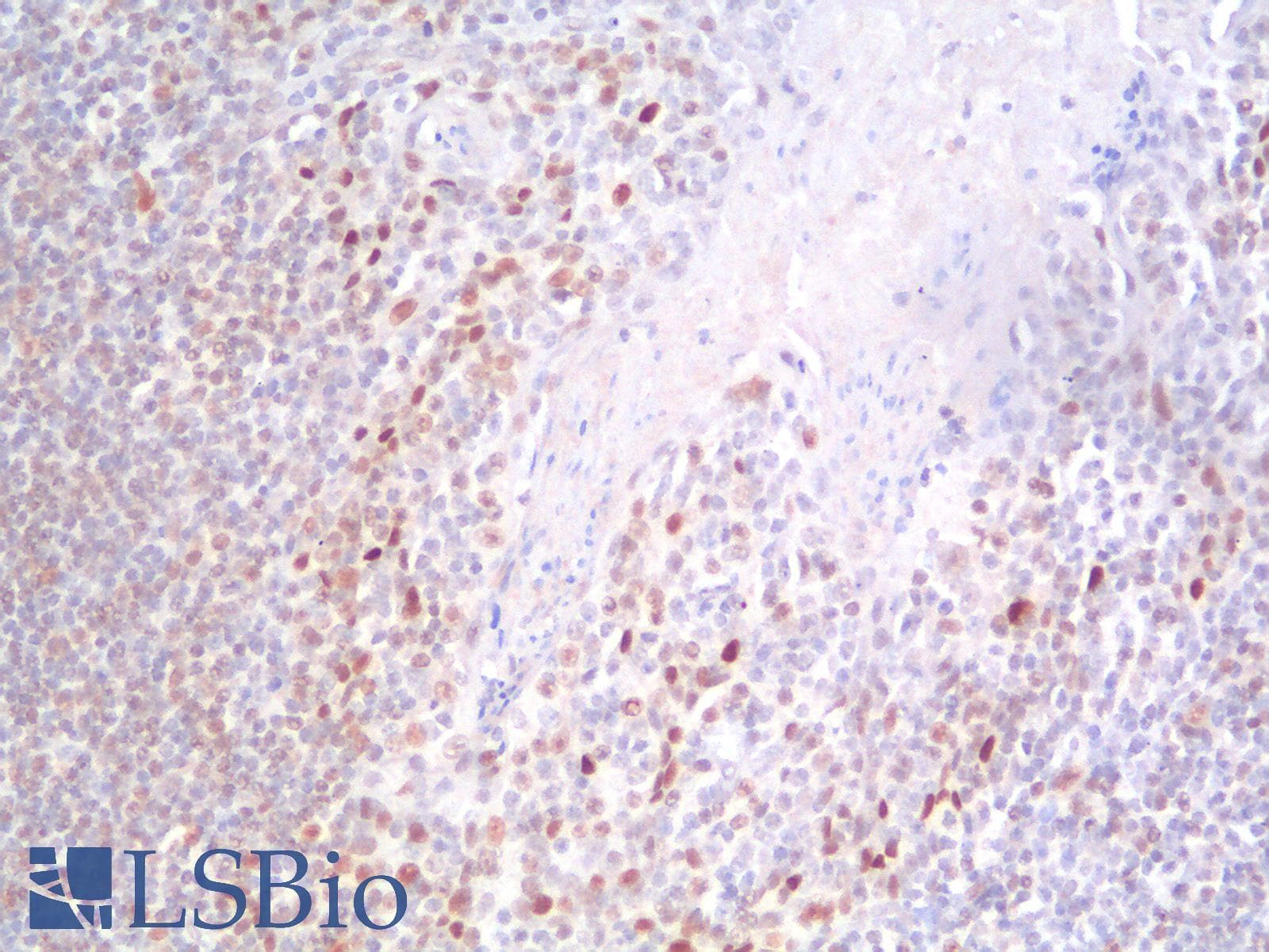 PathPlus™ TP53 / p53 Antibody (clone rBP53-12)