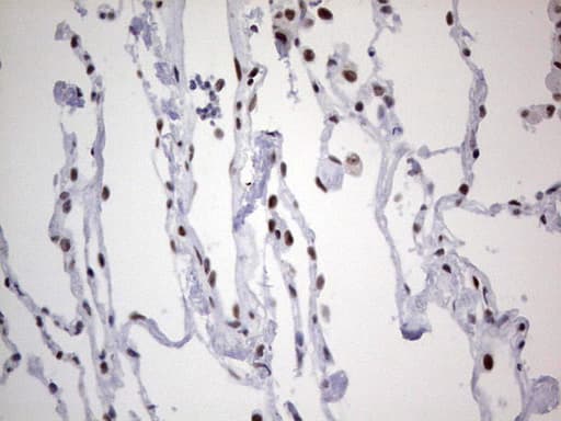 Monoclonal Mouse anti-Human HDAC9 Antibody (clone OTI7G2, aa181-460, IHC, WB)