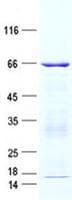 Human BCKDHB Protein (Recombinant GST, N-terminus + His, C-terminus)