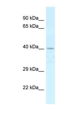 CTSE / Cathepsin E Antibody (aa183-232)