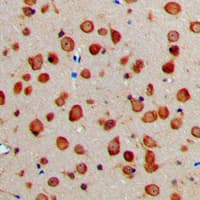 NXPH1 Antibody (Internal)