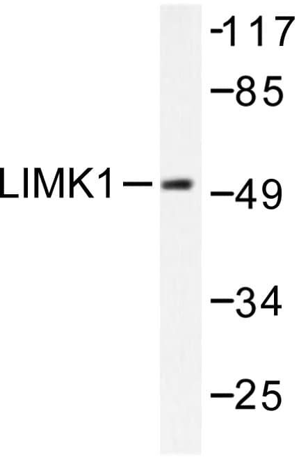 LIMK1 / LIMK Antibody (Asp502)
