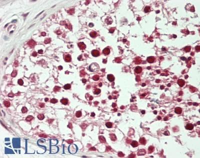 IHC-plus™ BABAM1 / HSPC142 Antibody (aa175-225)