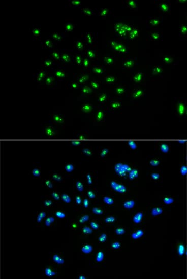 GNL3 / NS / Nucleostemin Antibody