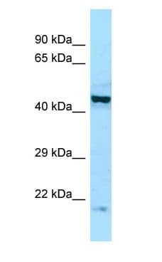 EIF2B2 Antibody (aa145-194)