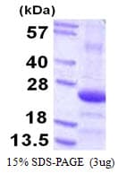 Human COPS8 / COP9 Protein (Recombinant His)