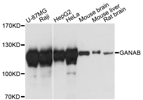 Polyclonal Rabbit anti-Human GANAB / Alpha Glucosidase II Antibody (WB)