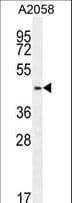 DCAF4L2 Antibody (aa1-30)