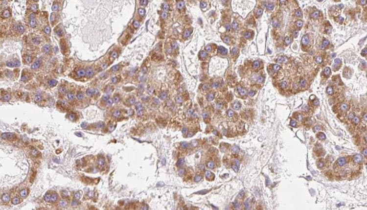 Polyclonal Rabbit anti-Human GNG12 Antibody (IHC, WB)