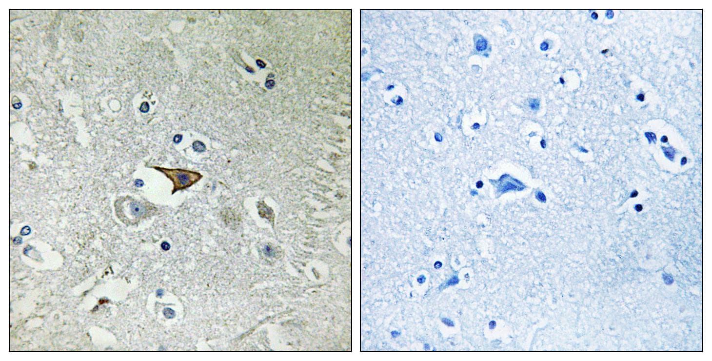 CCR5 Antibody (Ab-336)