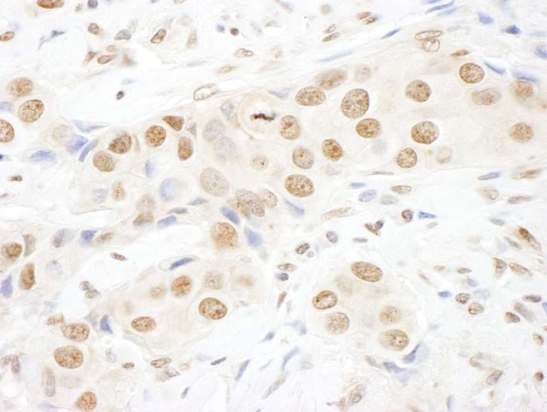 TOPORS Antibody (aa995-1045)